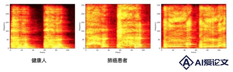 谷歌大模型下场，FDA完成首批，这个AI赛道起飞在即